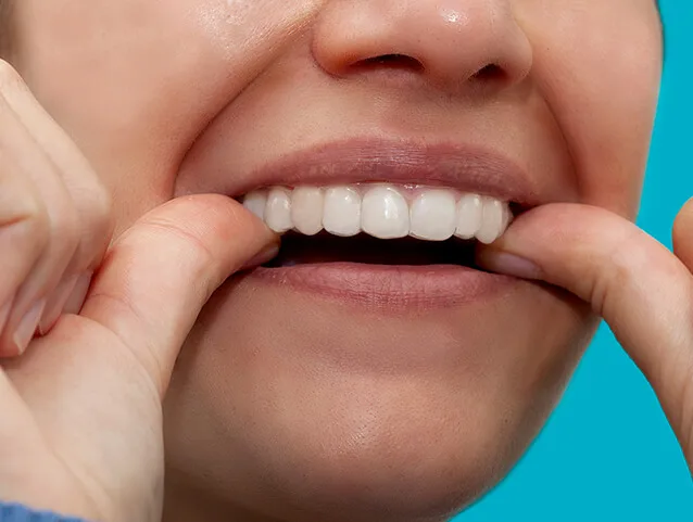 allineatori dentali invisibili