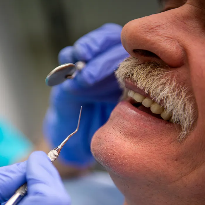 mantenimento parodontale del paziente in cura